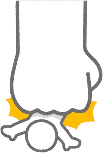 paunched emote