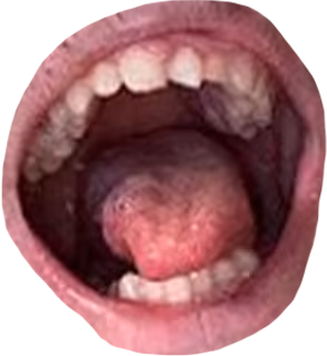 rickymouth emote