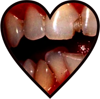 teeth_heart emote