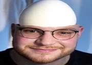 Eierkopf emote
