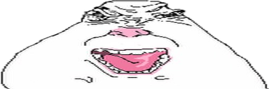 angy static emote
