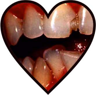 teeth_heart emote