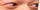 Champ emote