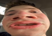 HYPO emote