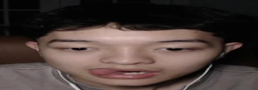 bleh emote