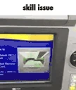 SkillIssue emote