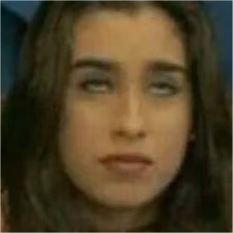 eyesbegone emote