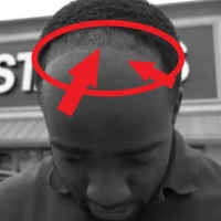 hairlineMessedUp_Jidion emote