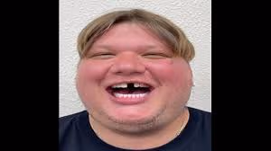 fats1mple emote