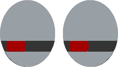 rexeyes