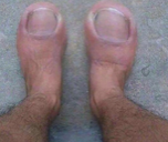 toes static emote
