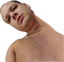 Thumb static emote