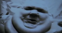 fat static emote