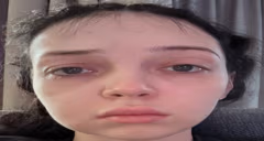 000 emote